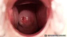 Putar Mengadakan zaneta speculum onanism di klinik